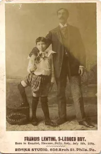Francesco Lentini